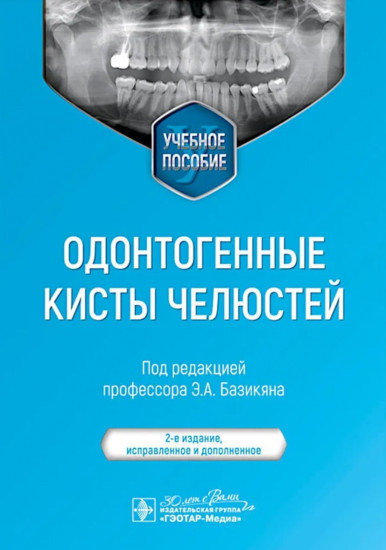 Одонтогенные кисты челюстей