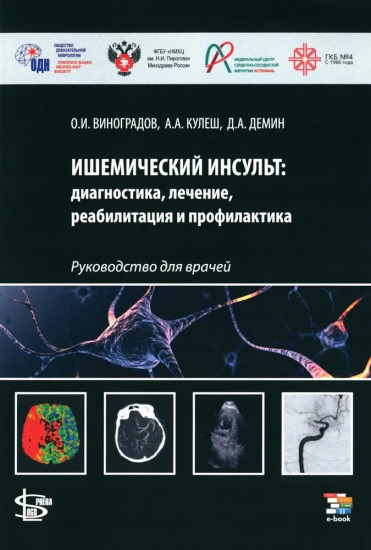 Ишемический инсульт: диагностика, лечение, реабилитация и профилактика. Руководство для врачей