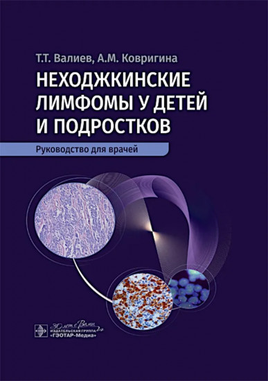 Неходжкинские лимфомы у детей и подростков