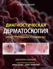 Диагностическая дерматоскопия: иллюстрированное руководство