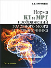 Норма КТ и МРТ изображений головного мозга и позвоночника. Атлас изображений