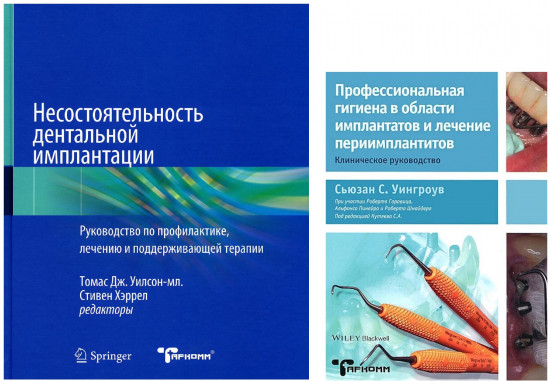 Профессиональная гигиена в области имплантатов и лечение периимплантитов. Несостоятельность дентальной имплантации