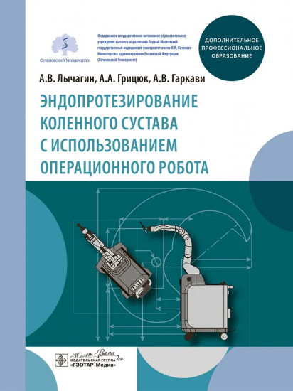 Эндопротезирование коленного сустава с использованием операционного робота