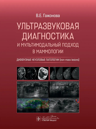 Ультразвуковая диагностика и мультимодальный подход в маммологии. Диффузные неузловые патологии