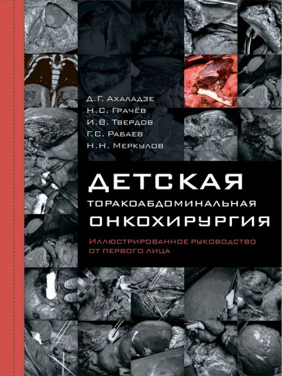 Детская торакоабдоминальная онкохирургия. Иллюстрированное руководство от первого лица
