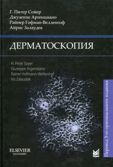 Дерматоскопия