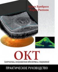 ОКТ (сетчатка, сосудистая оболочка