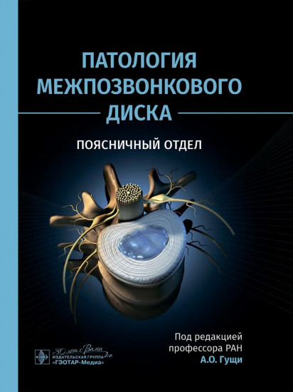 Патология межпозвонкового диска. Поясничный отдел