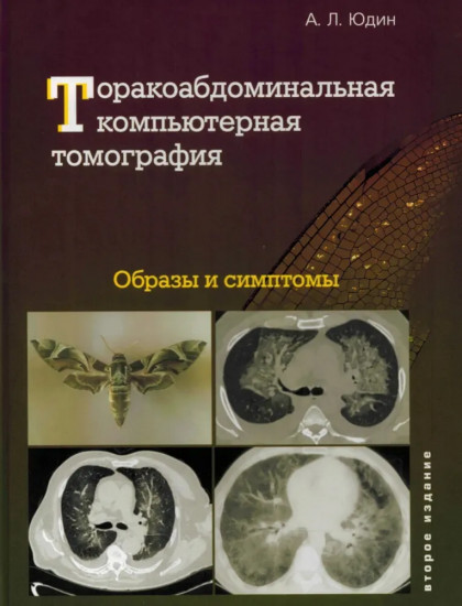 Торакоабдоминальная компьютерная томография. Образы и симптомы