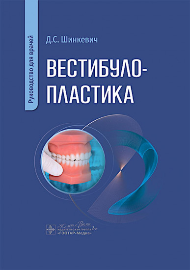 Вестибулопластика