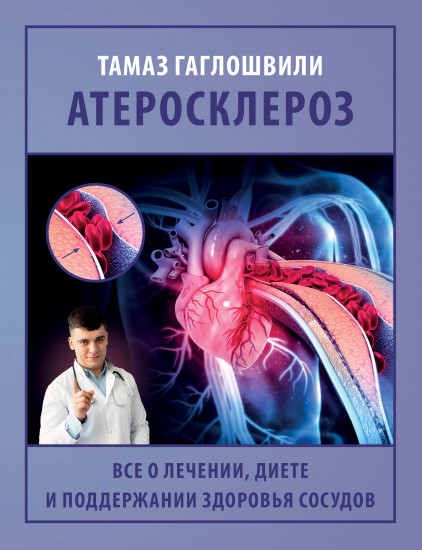 Атеросклероз. Всё о лечении, диете и поддержании здоровья сосудов