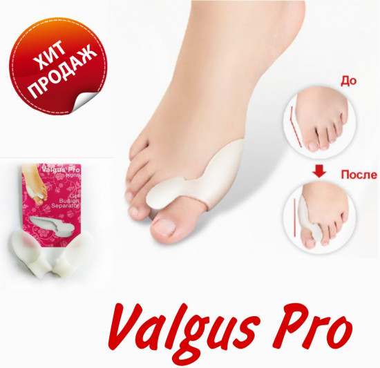 Силиконовые протекторы для пальцев стопы «Valgus Pro»