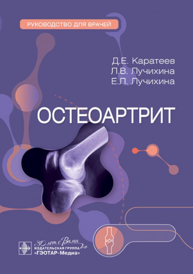 Остеоартрит