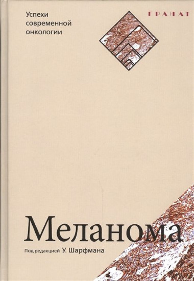 Меланома