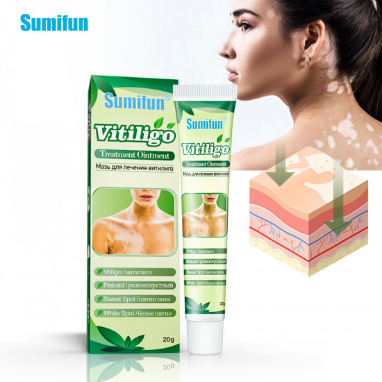 Мазь для лечения витилиго, белых пятен и пигментных нарушений «Vitiligo Treatment Ointment»