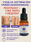 Средство от грибка ногтей «Онихомикоза»