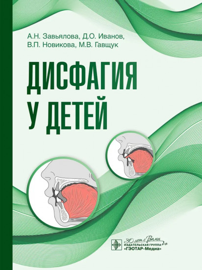 Дисфагия у детей