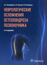 Неврологические осложнения остеохондроза позвоночника