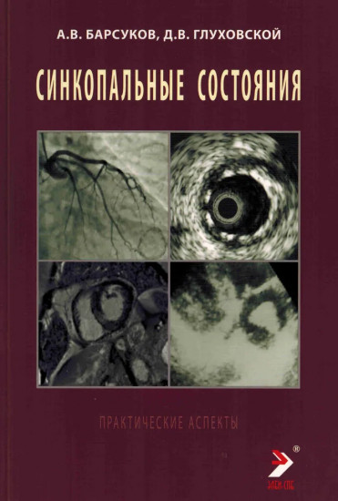 Синкопальные состояния. Практические аспекты