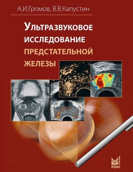 Ультразвуковое исследование предстательной железы