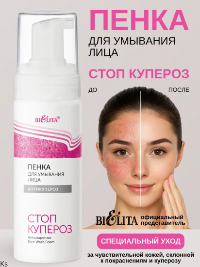 Пенка для умывания лица «Антикупероз»