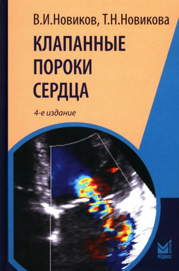 Клапанные пороки сердца
