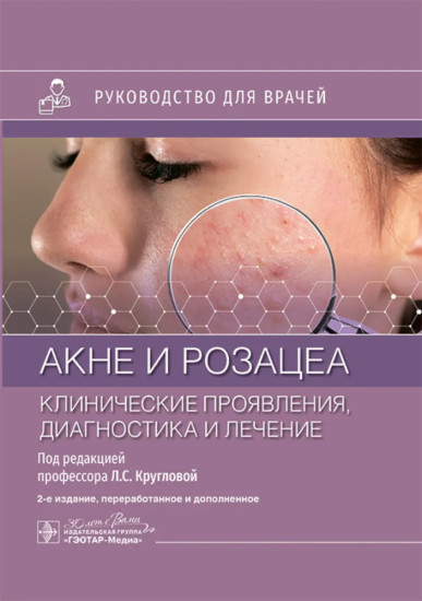 Акне и розацеа. Клинические проявления, диагностика и лечение