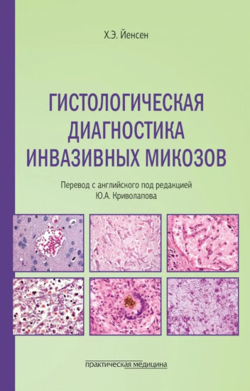 Гистологическая диагностика инвазивных микозов
