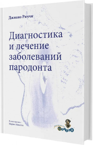 Диагностика и лечение заболеваний пародонта