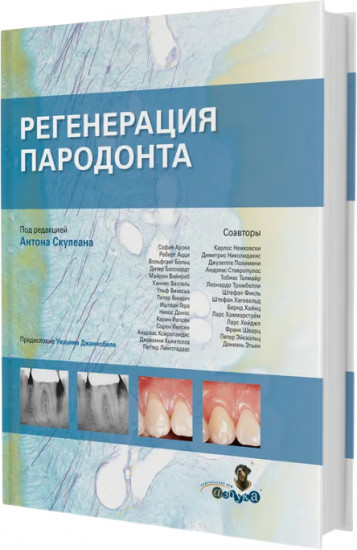 Регенерация пародонта