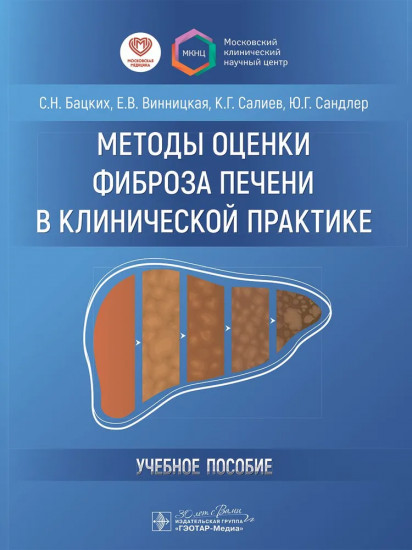 Методы оценки фиброза печени в клинической практике. Учебное пособие