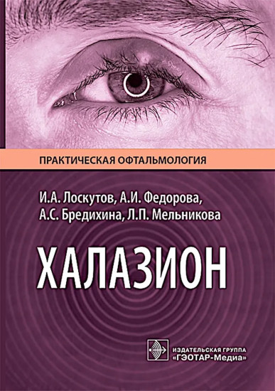 Халазион