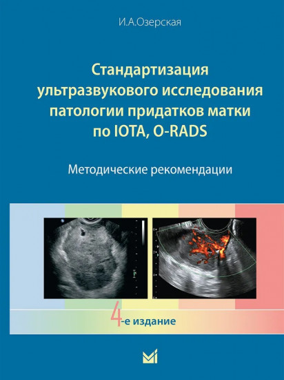 Стандартизация ультразвукового исследования патологии придатков матки по IOTA, O-RADS