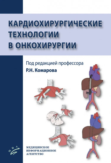 Кардиохирургические технологии в онкохирургии