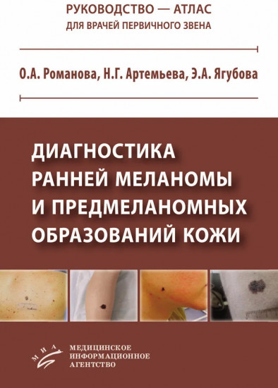 Диагностика ранней меланомы и предмеланомных образований кожи