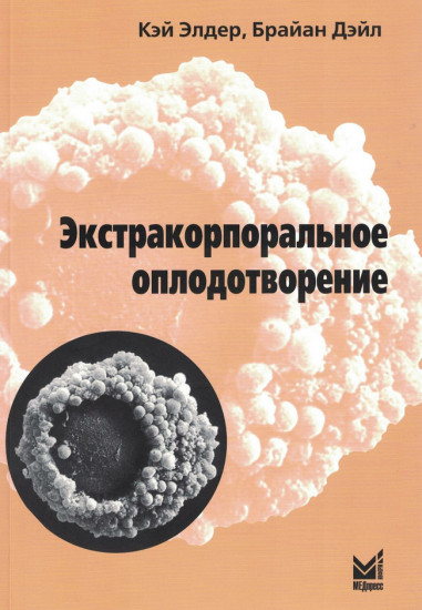 Экстракорпоральное оплодотворение