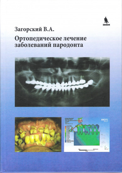 Ортопедическое лечение