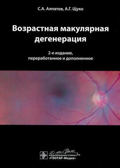Возрастная макулярная дегенерация