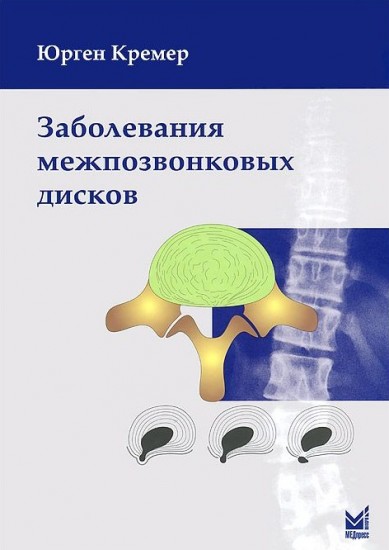 Заболевания межпозвонковых дисков