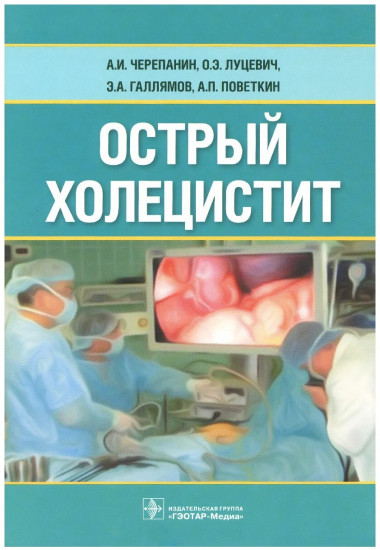 Острый холецистит