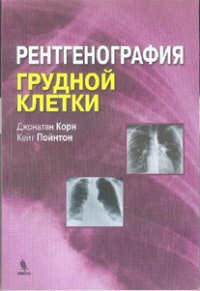 Рентгенография грудной клетки