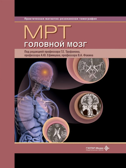 МРТ. Головной мозг