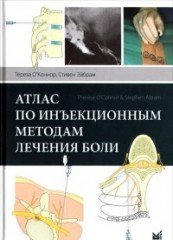 Атлас по инъекционным методам лечения боли