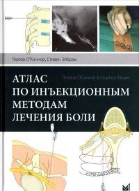 Атлас по инъекционным методам лечения боли