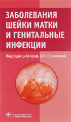 Заболевания шейки матки