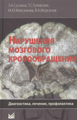 Нарушения мозгового кровообращения