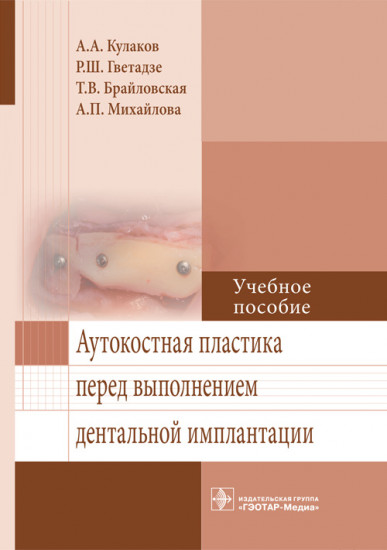 Аутокостная пластика перед выполнением дентальной имплантации. Учебное пособие