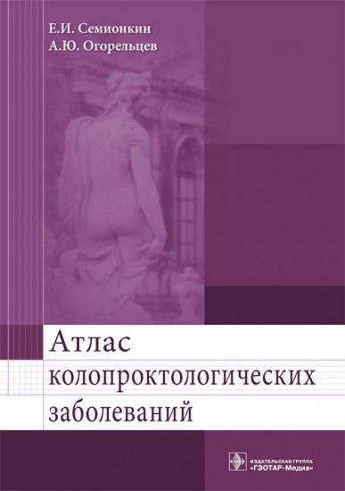 Атлас колопроктологических заболеваний