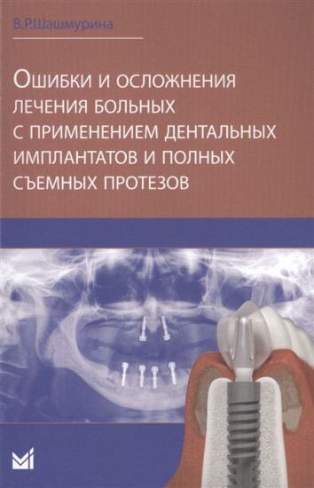 Ошибки и осложнения лечения больных с применением дентальных имплантатов и полных съемных протезов