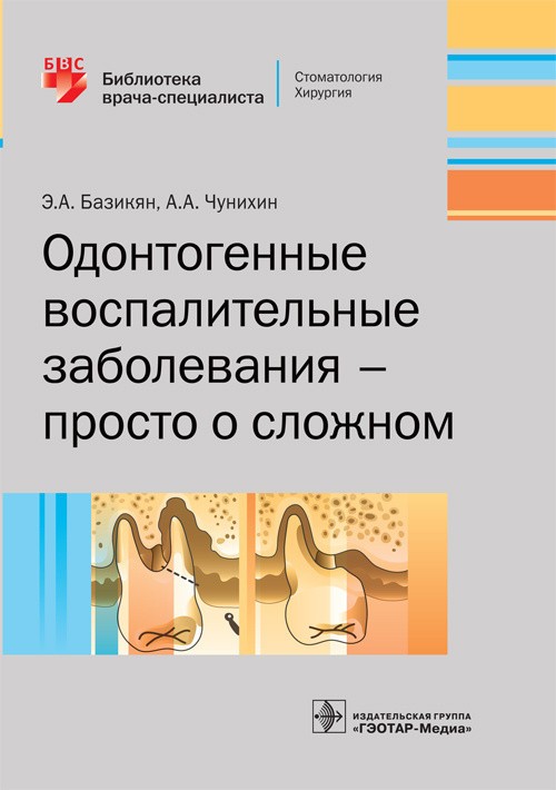 Одонтогенные воспалительные заболевания — просто о сложном